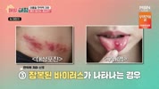 미리보기 이미지